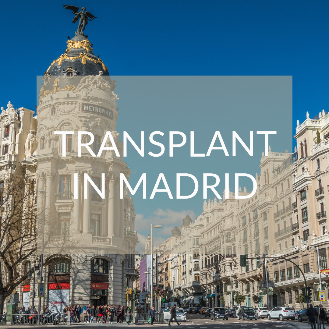 Madrid hair transplant